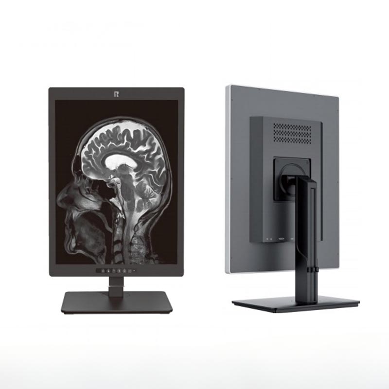 20,1 hüvelykes, 2 MP-es orvosi diagnosztikai monitor