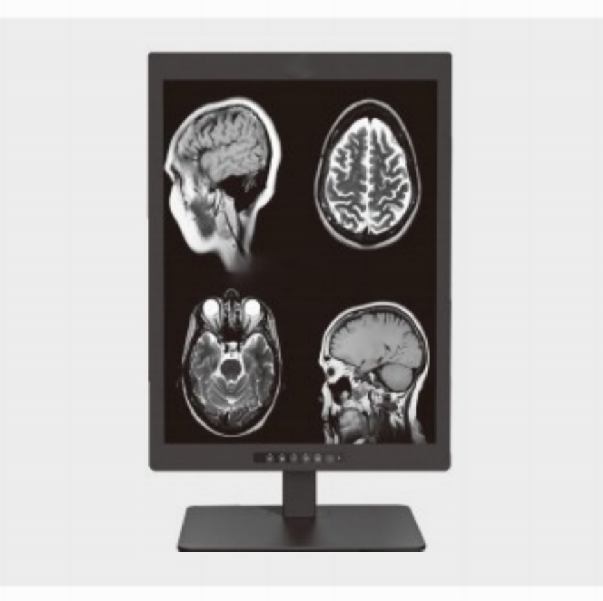 Hol használnak gyakran 20,1 hüvelykes 2 MP-es orvosi diagnosztikai kijelzőt?