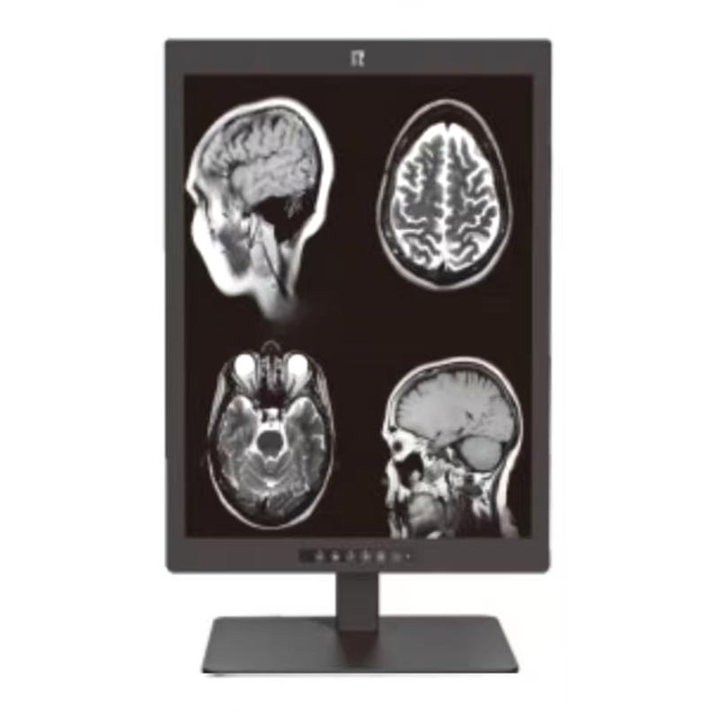 21,3 hüvelykes 3 MP-es orvosi diagnosztikai monitor