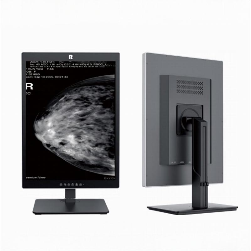 21,3 hüvelykes 5 MP-es orvosi diagnosztikai monitor