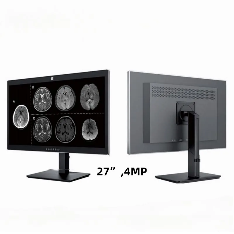 27 hüvelykes 4 MP-es orvosi diagnosztikai monitor