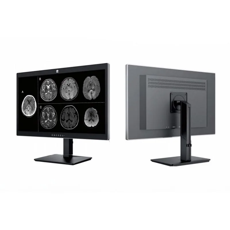 27 hüvelykes 8 MP-es orvosi diagnosztikai monitor