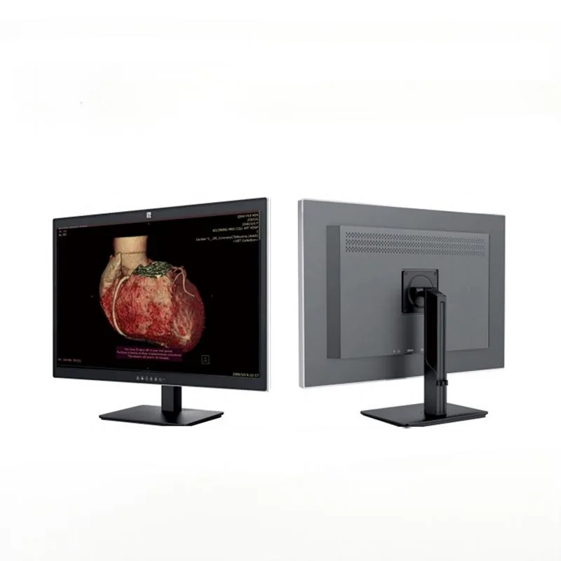 30 hüvelykes 6 MP-es orvosi diagnosztikai monitor