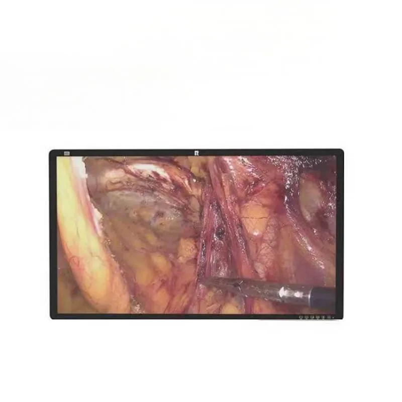 32 hüvelykes 4K sebészeti orvosi monitor