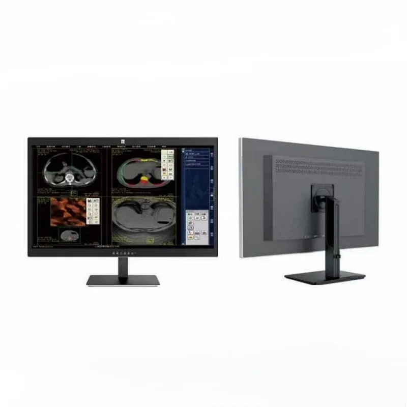 32 hüvelykes 8 MP-es orvosi diagnosztikai monitor