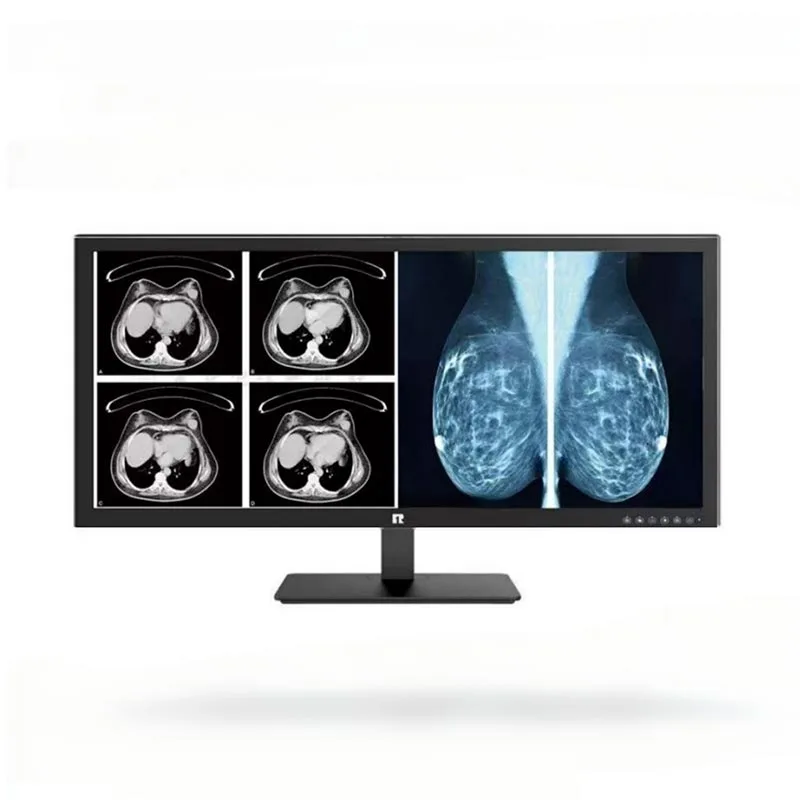 34 hüvelykes 5 MP-es orvosi diagnosztikai monitor