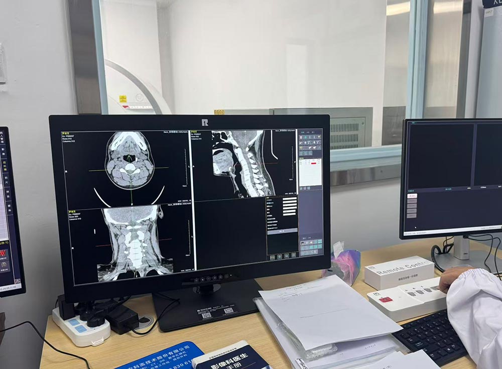 32-inch 8MP Medical Diagnostic Display